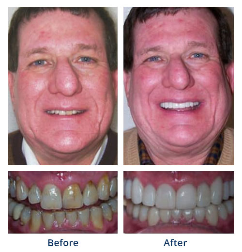 Before-and-after smile gallery case 2